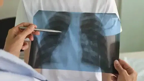  What are the Stages of Pneumonia?
